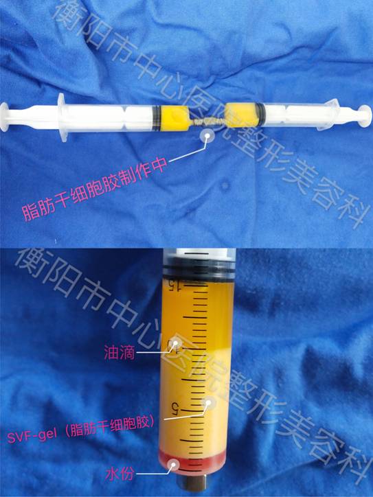 2018101012314277.jpg 2018101012314277.jpg